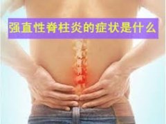 驻马店治疗强直性脊柱