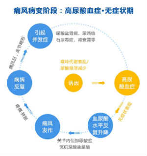痛风病变阶段:高尿酸血症,无症状期.jpg 痛风病变阶段:高尿酸血症,无症状期.jpg