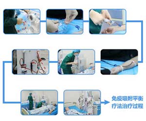 免疫吸附平衡疗法治疗过程.jpg 免疫吸附平衡疗法治疗过程.jpg